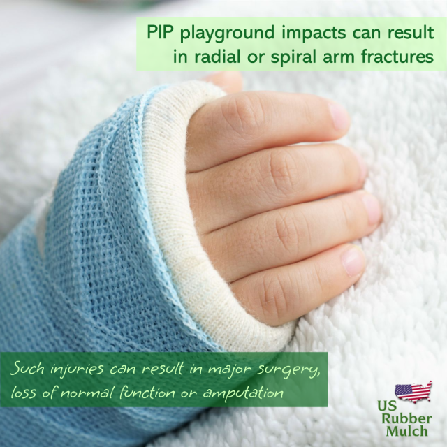 Climbing equipment is responsible for the most playground injuries